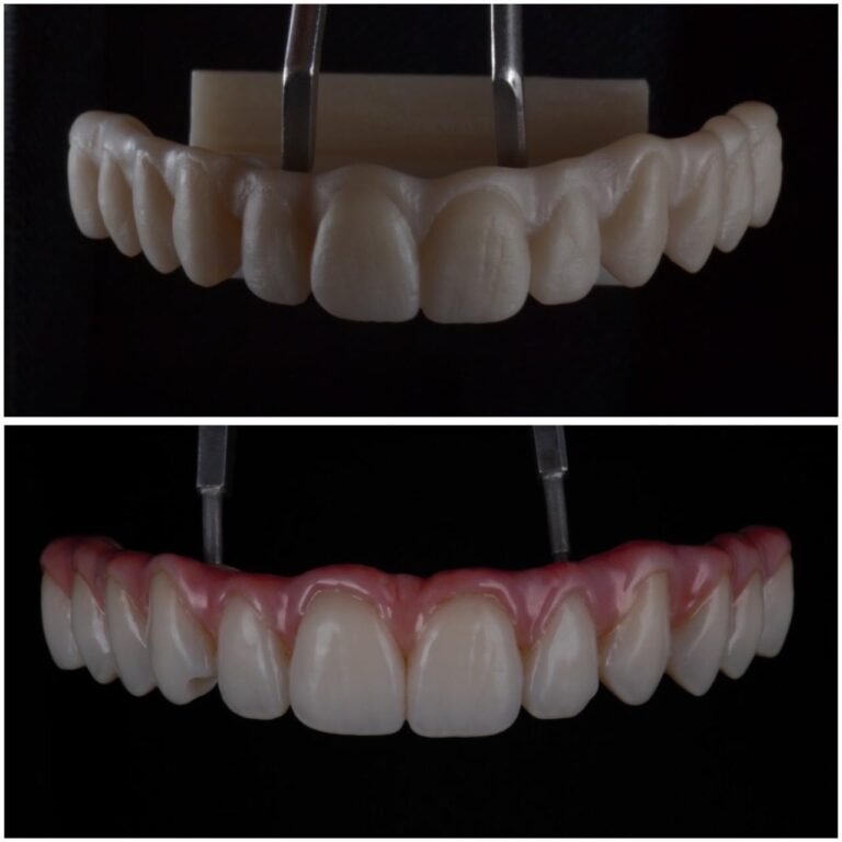 protese dentaria gaudio odontologia