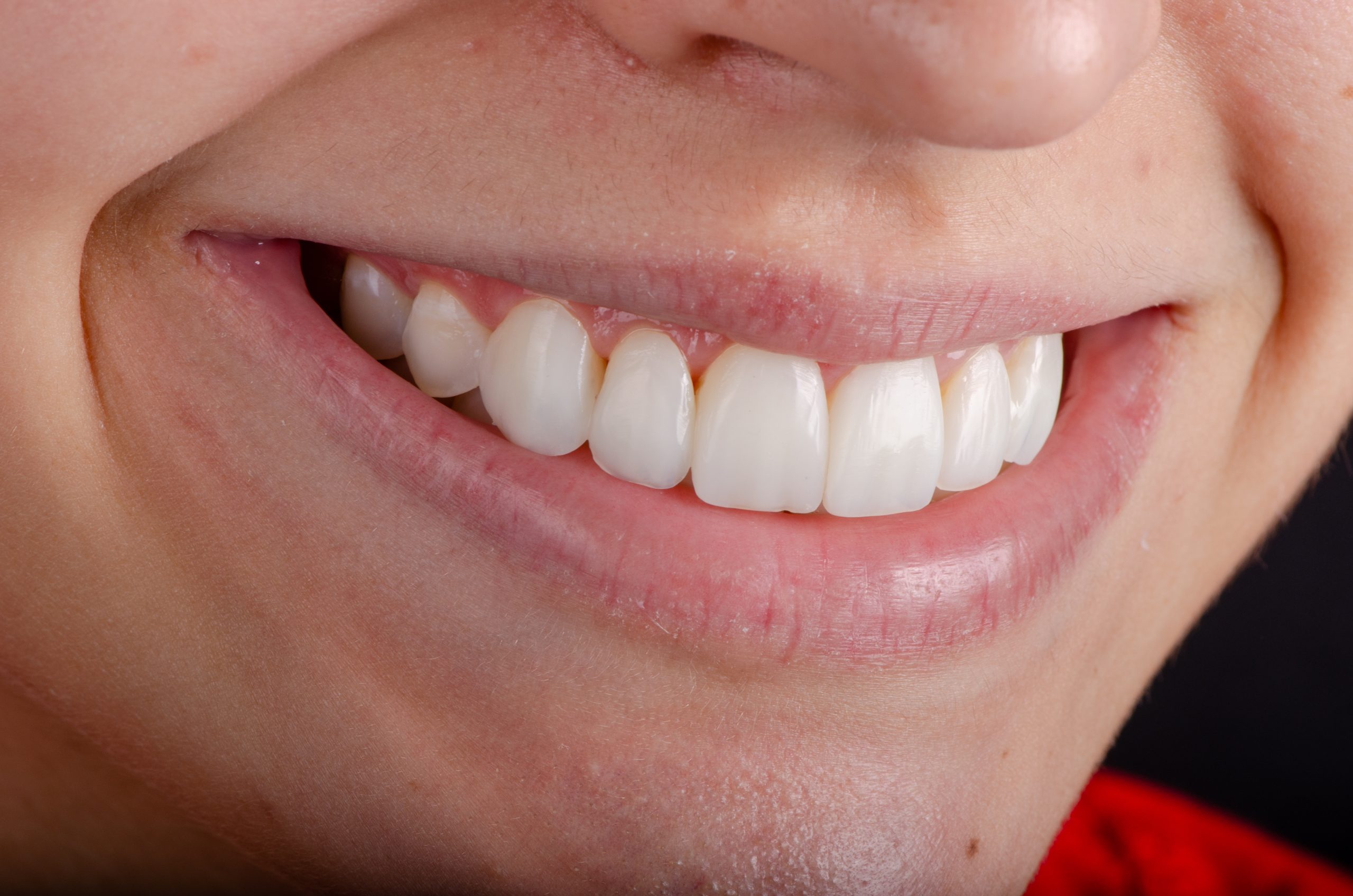 lentes resinas pagina