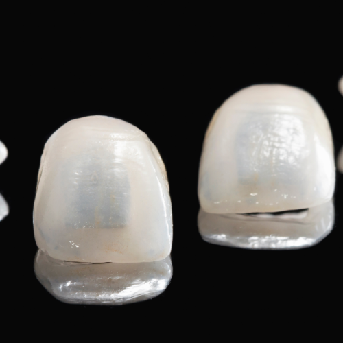 Facetas – Lente de contato dental