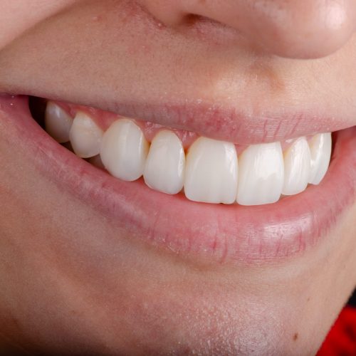 lentes resinas pagina